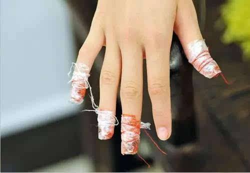 指甲花的养殖方法功效与作用能治灰指甲吗 指甲花怎么染头发技巧