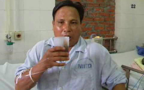 狂犬病早期有哪些症状?这些症状不可忽视