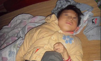 狂犬病早期有哪些症状?这些症状不可忽视